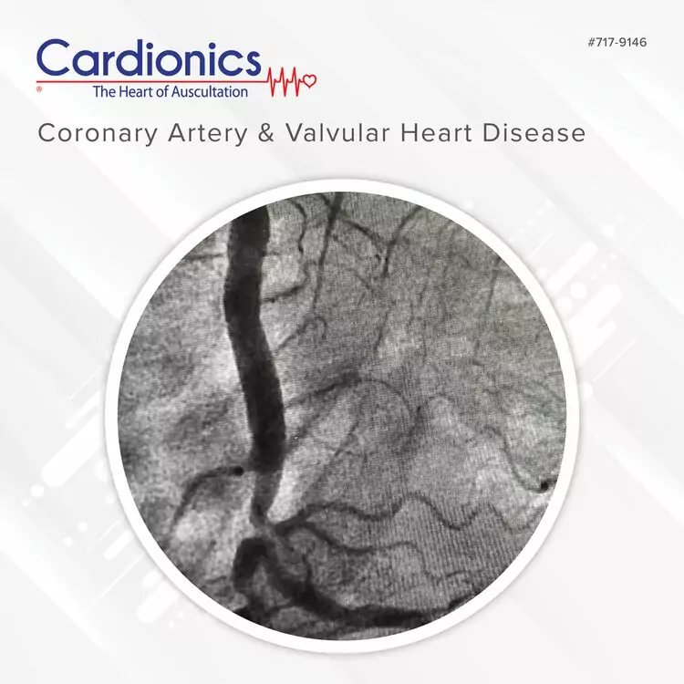 Learning Coronary Artery & Valvular Heart Disease