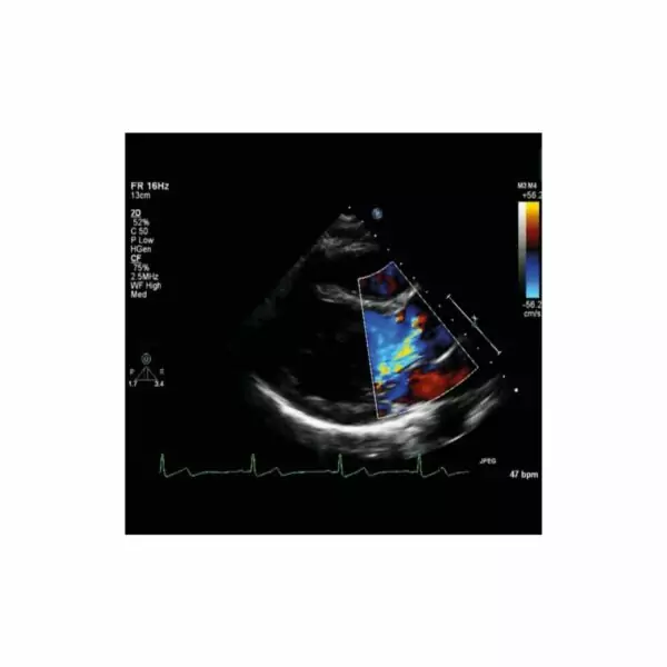 SAM4 Plus Auscultation Manikin - Image 9