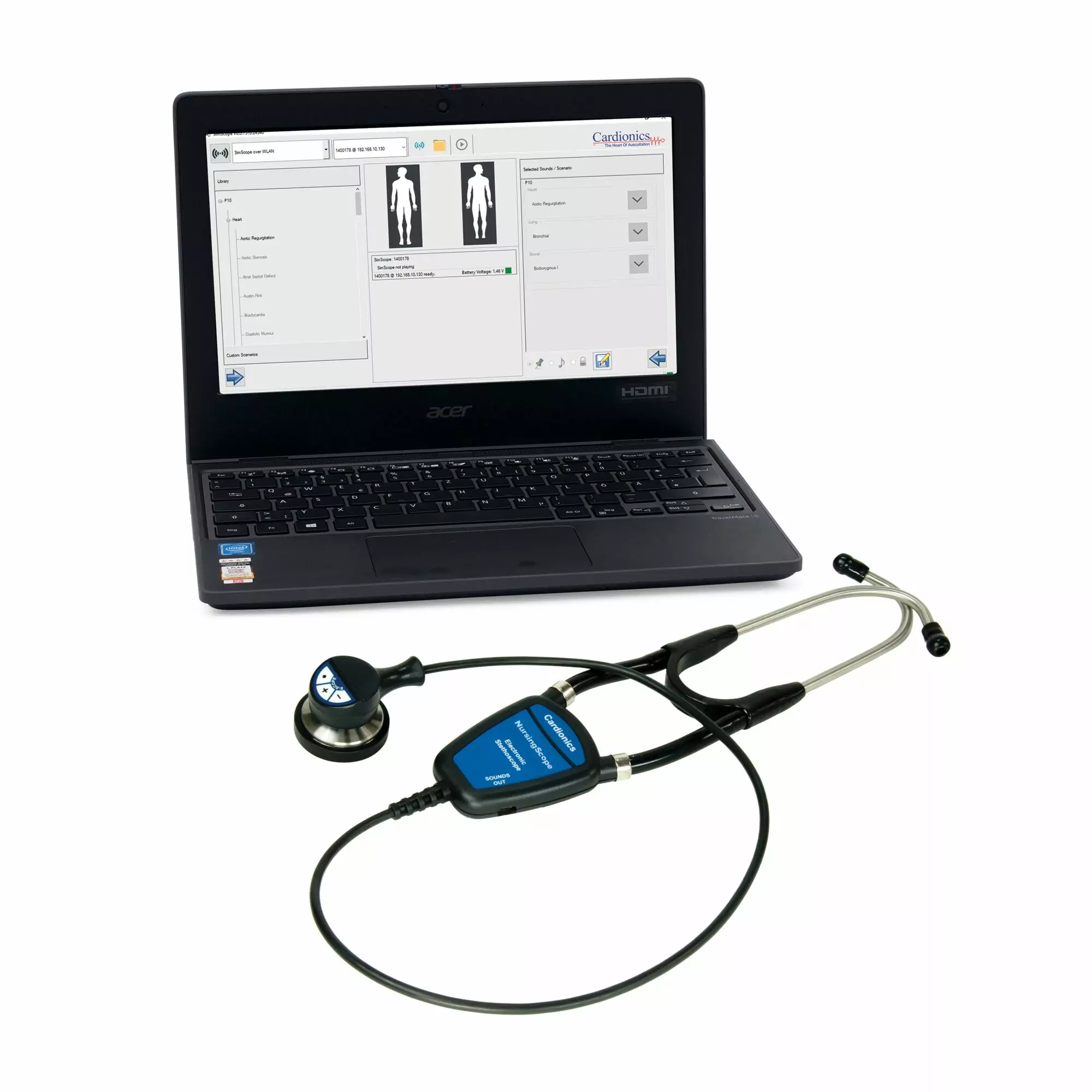 Nikki the Nursing Manikin with Auscultation - Image 2